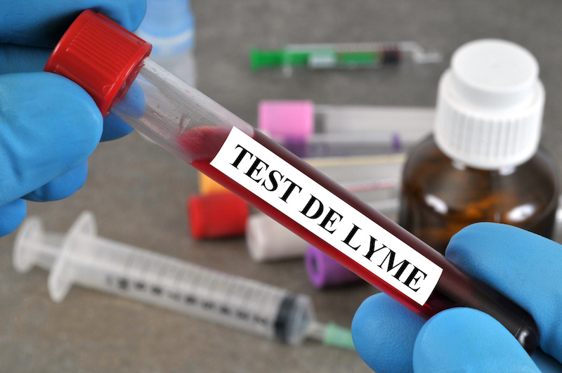 Eprubeta Test Boala Lyme